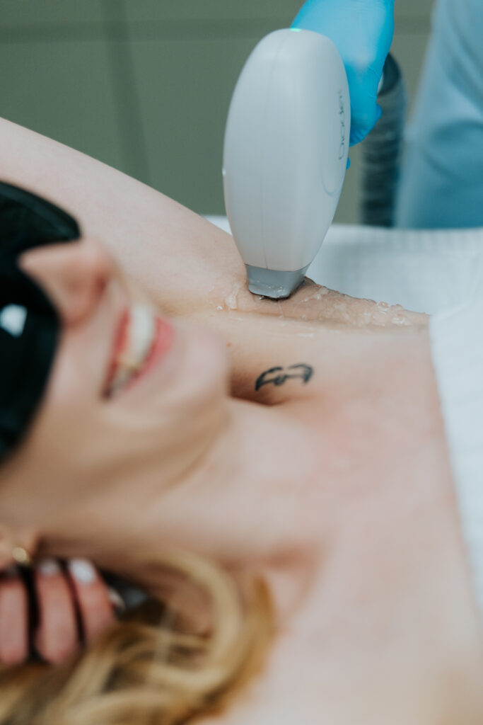 Depilacja laserowa katowice